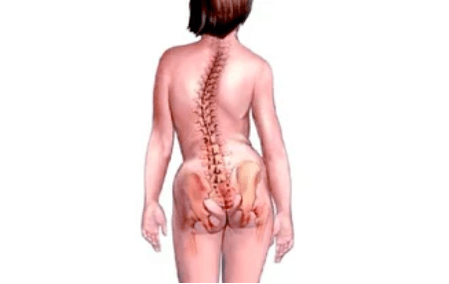 raisons du développement de l'ostéochondrose cervicale